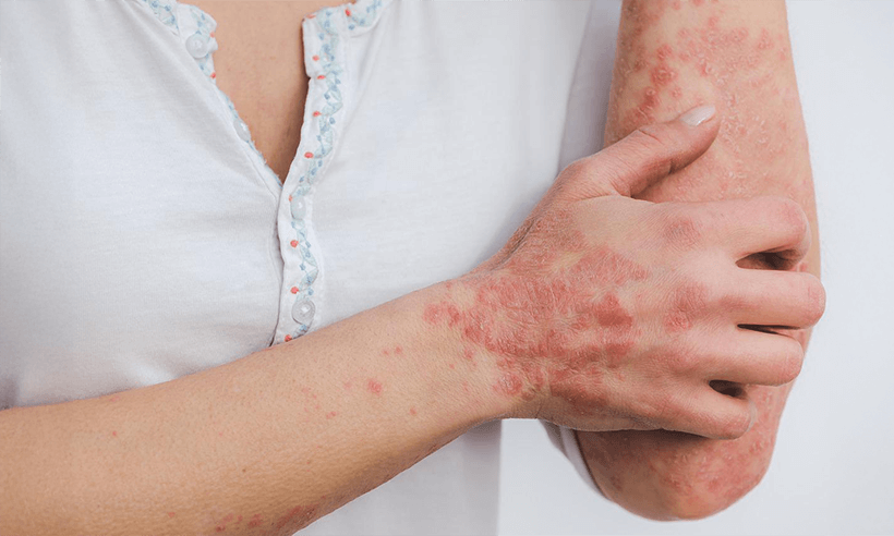 Remove Musty Odor from Wardrobes