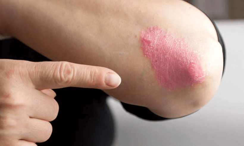 Unclog a Slow Sink Drain